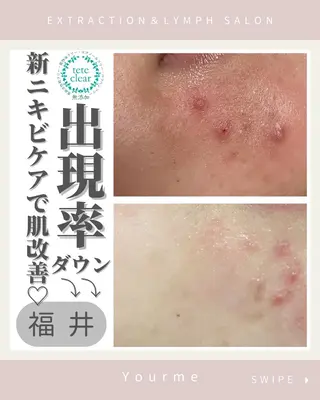 毛穴肌質ケアサロン Yourmeユアミーのエステ・リラクイメージ