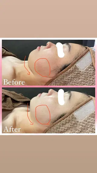 salon〜RePCa〜(サロンルピカ)所属・山﨑 藍のエステ・リラクイメージ