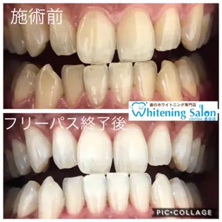 歯科レベルの白さ💎 ✨ホワイトニング豊田のエステ・リラクイメージ