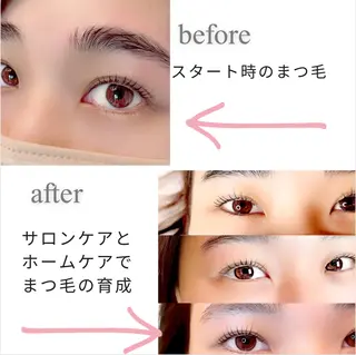 マツエク・マツパ sprinkles loungeのエステ・リラクイメージ