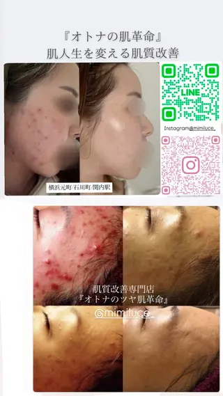 mimiluce ミミルーチェのマツエク・マツパデザイン