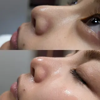 Morphome所属・【Morphome】 hinaのエステ・リラクイメージ