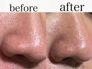 ナリス化粧品De I’mあべのルシアス所属・山本 紗織のエステ・リラクイメージ