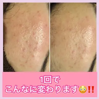 ミディアム カラー パーマ ヘアアレンジ メンズ キッズ ネイル マツエク・マツパ ニキビ・肌質改善専門 ♡人生が変わるサロンのエステ・リラクイメージ