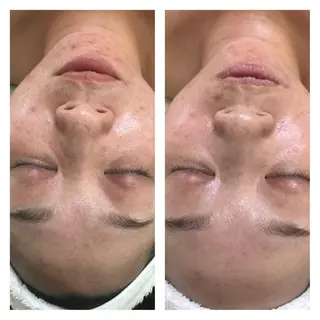 フェアリーローズ所属・fairyrose organicエステのエステ・リラクイメージ