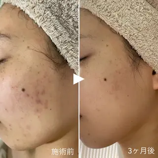 シェノン所属・ニキビ・毛穴・ フェイシャル専門店のその他イメージ