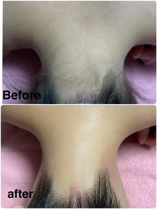 エステ脱毛 MAIのエステ・リラクイメージ