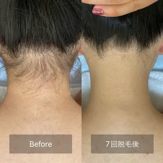 港区都度払い脱毛 miranjuのエステ・リラクイメージ