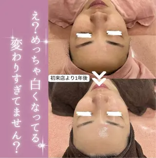 【現役看護師】高来 笑子のエステ・リラクイメージ