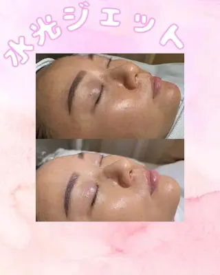 アイブロウ aliaハイフ&水光ジェットサロン所属・aliaハーブ水光店 エステティシャン募集のエステ・リラクイメージ