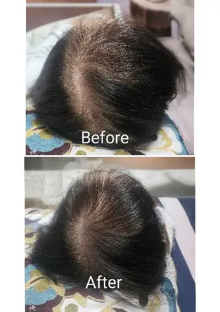 歯科提携セルフダック 宇都宮駒生店のエステ・リラクイメージ