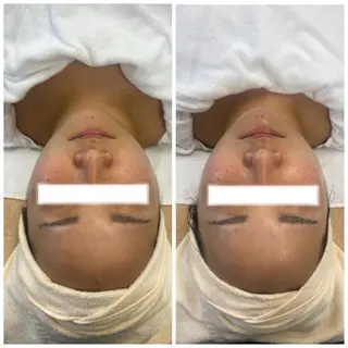 マツエク・マツパ アイブロウ 肌質改善美容サロン ému 用賀のエステ・リラクイメージ