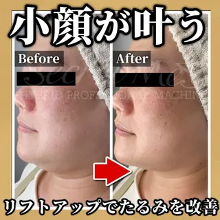 脱毛＆フェイシャル TOWA大宮のエステ・リラクイメージ