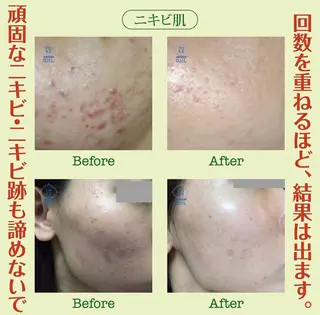 217whitening  room所属・217 ホワイトニングルームのエステ・リラクイメージ