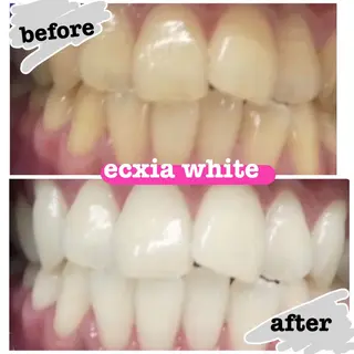 エクシアホワイトニング日本橋所属・エクシア ホワイトニング日本橋のその他イメージ