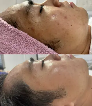 TotalSalon Briller所属・Nakashita Sayakaのエステ・リラクイメージ