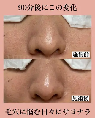 MIRI所属・北堀江/毛穴改善専門 ミリのエステ・リラクイメージ