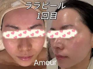 痩身・小顔・脱毛・ オイル&Amourのエステ・リラクイメージ