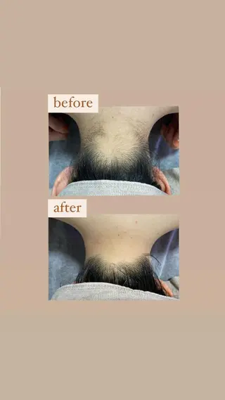 crescent所属・【韓国肌管理・脱毛】 クレセントのその他イメージ