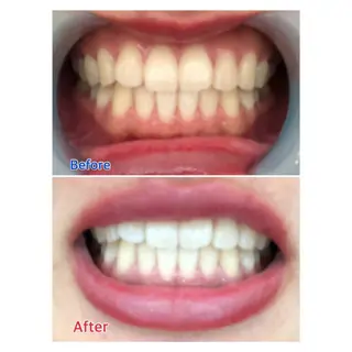 MBEAUTYSALON 千葉店・京成大久保所属・Melty 輝のその他イメージ