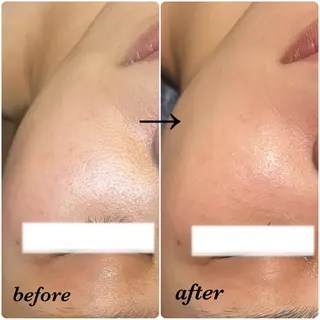 salon akua nail＆リラクのネイルデザイン