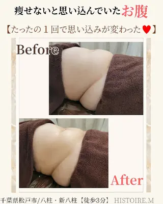 HISTOIRE.M イストアールエム所属・ダイエット/体質改善 /筋膜リリース専門店のエステ・リラクイメージ