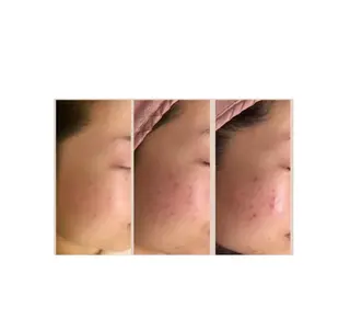 癒し腸もみサロン シャユーム　ゆきなのエステ・リラクイメージ