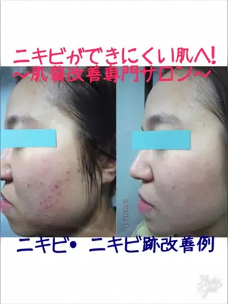 Facial stylist salon伊勢崎所属・中島 有希のエステ・リラクイメージ
