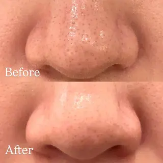 Hari Lounge恵比寿所属・chika🦋 ハリラウンジ恵比寿のエステ・リラクイメージ