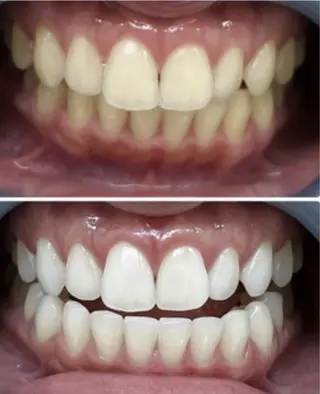 セルフホワイトニングサロンMW 錦糸町店所属・セルフホワイトニング サロンMW錦糸町店のその他イメージ