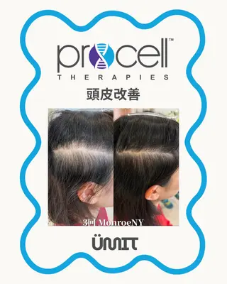 Ümit（ユミト） プロセルセラピーズのネイルデザイン