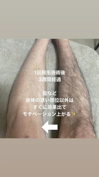 メンズ 脱毛サロン KAvanceのエステ・リラクイメージ