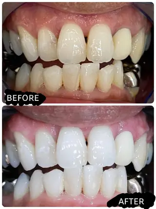 ホワイトニングサロン ラウレアのその他イメージ