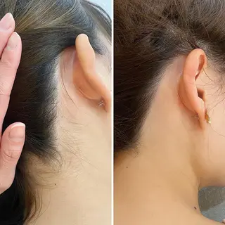 うなじ脱毛/美肌脱毛 LABELのエステ・リラクイメージ