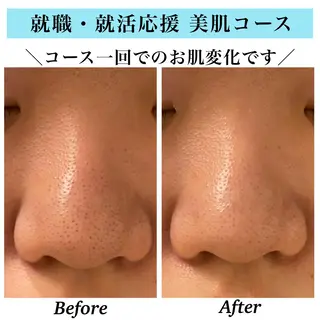 Bellesthe （ベルエステ）のエステ・リラクイメージ