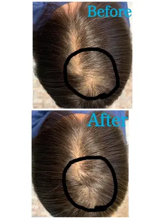 ヘアアレンジ Kanal Kanaのエステ・リラクイメージ