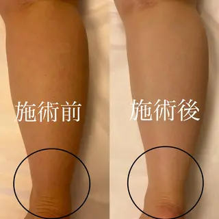 WOM SALON所属・MIKU【美容整形ダ ウンタイムケア銀座】のエステ・リラクイメージ