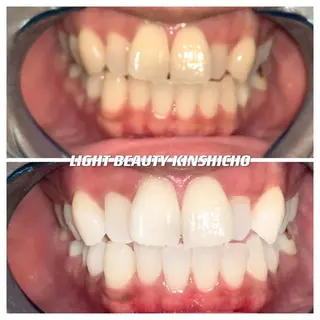 ライトビューティー 錦糸町店のエステ・リラクイメージ