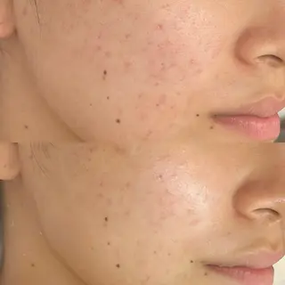 韓国🇰🇷価格 サロン_Nbibiのエステ・リラクイメージ