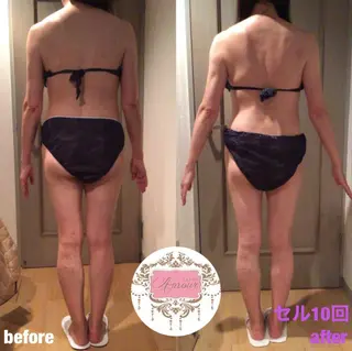 salonAmour所属・salon amourのエステ・リラクイメージ