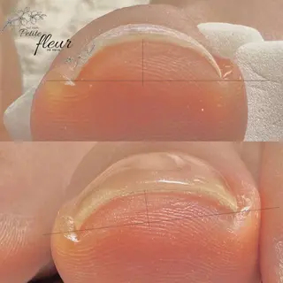 ネイル ❁⃘*。Petite fleur❁⃘*りさのネイルデザイン