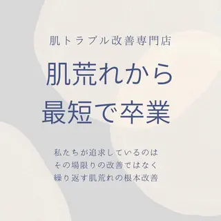 夏までに肌荒れ卒業 するサロン🌻のエステ・リラクイメージ