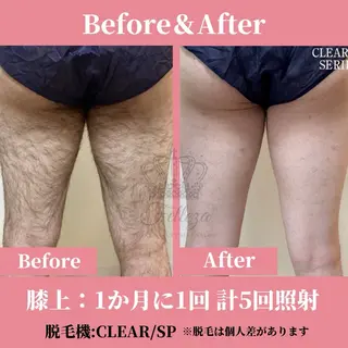 メンズ 有人型セルフサロン 脱毛/痩身/美顔のその他イメージ