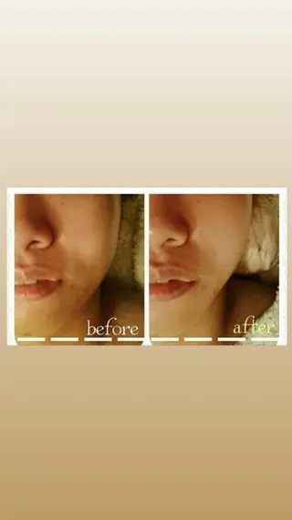 MENARD ＊泉ヶ丘駅前店＊のエステ・リラクイメージ