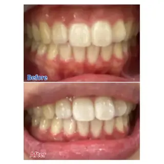 M渋谷店所属・Ｍ渋谷 ホワイトニングのエステ・リラクイメージ