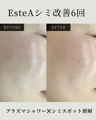 シミ毛穴|眉Wax THE  flowのエステ・リラクイメージ