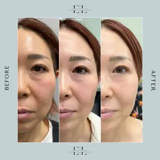 Joélle Studio所属・Joélle Studioのエステ・リラクイメージ