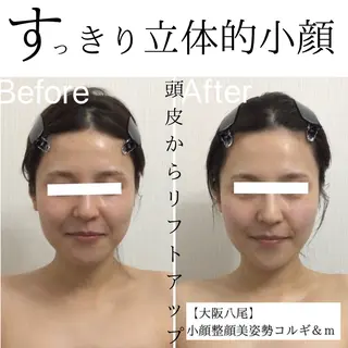 リフトアップ小顔 専門のエステ・リラクイメージ