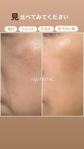 ヘッドスパ専門/豊中 apricotのエステ・リラクイメージ