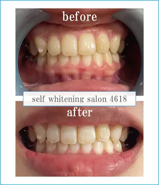 self whitening salon 4618所属・ホワイトニングサロン 4618のその他イメージ